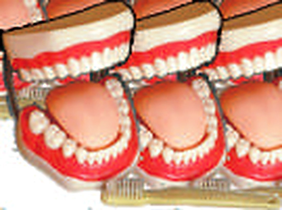 ADULT GUM TEETH MODEL - This model is to serve for demonstation in mouth protection and relative clinical teaching. With brush. (Equivalent Model No. XC-403) — product photograph | VistaStay Med