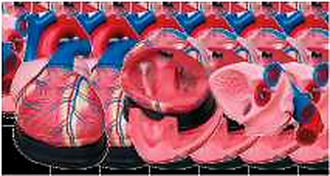 JUMBO HEART MODEL (IMPORTED)