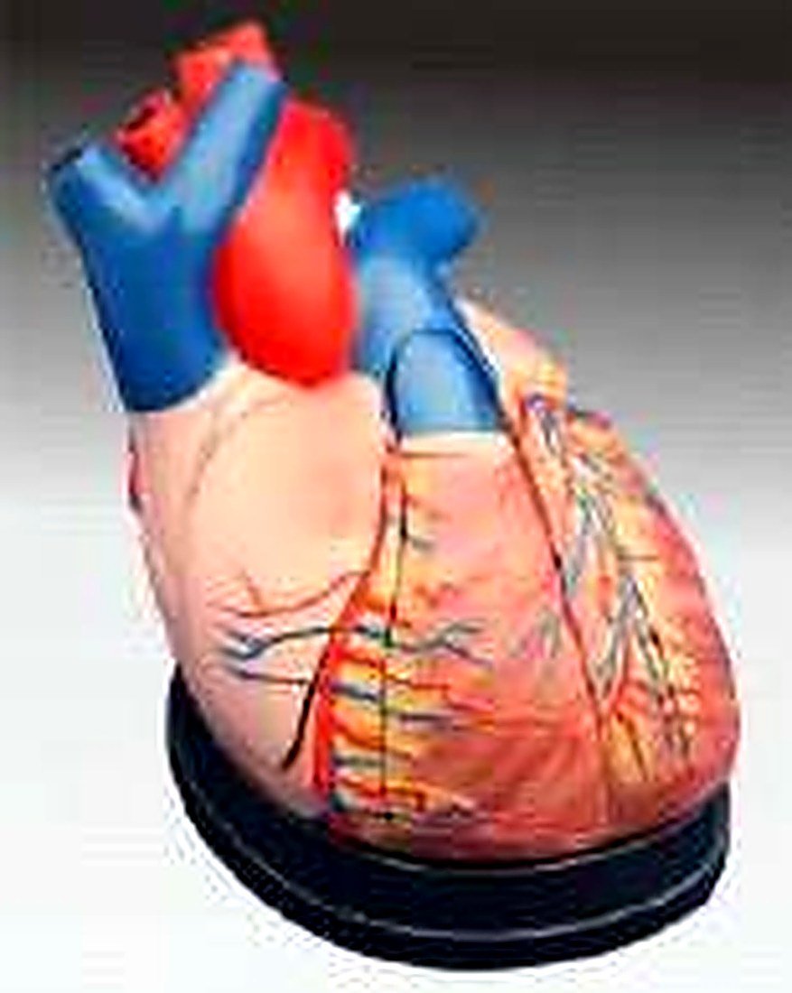 MIDDLE HEART MODEL(IMPORTED) - This model — product photograph | VistaStay Med