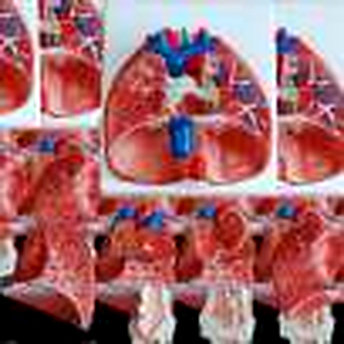 Larynx, Heart & Lungs Model(Imported) — product photograph | VistaStay Med