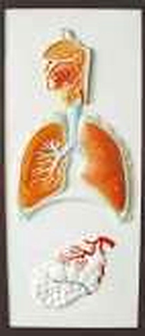 Relief model of respiratory system (IMPORTED) — product photograph | VistaStay Med