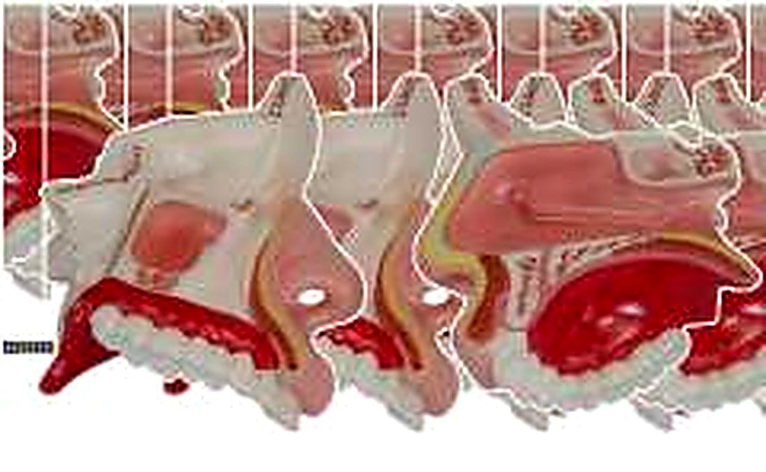 Model Of Anatomical Nasal Cavity — product photograph | VistaStay Med