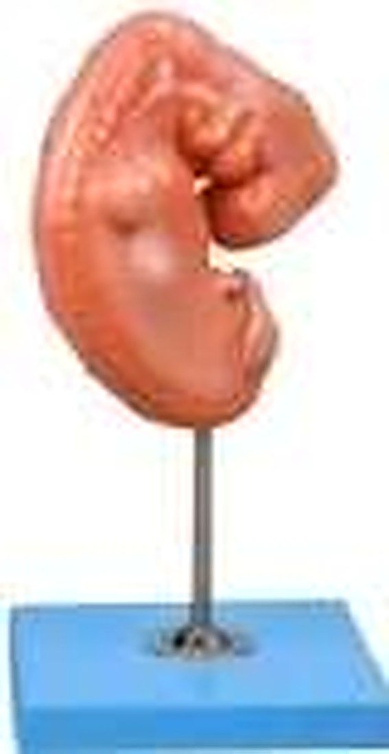 EMBRYO MODEL (IMPORTED) - The embryo model is about 4 weeks old, and mounted on a stand. — product photograph | VistaStay Med