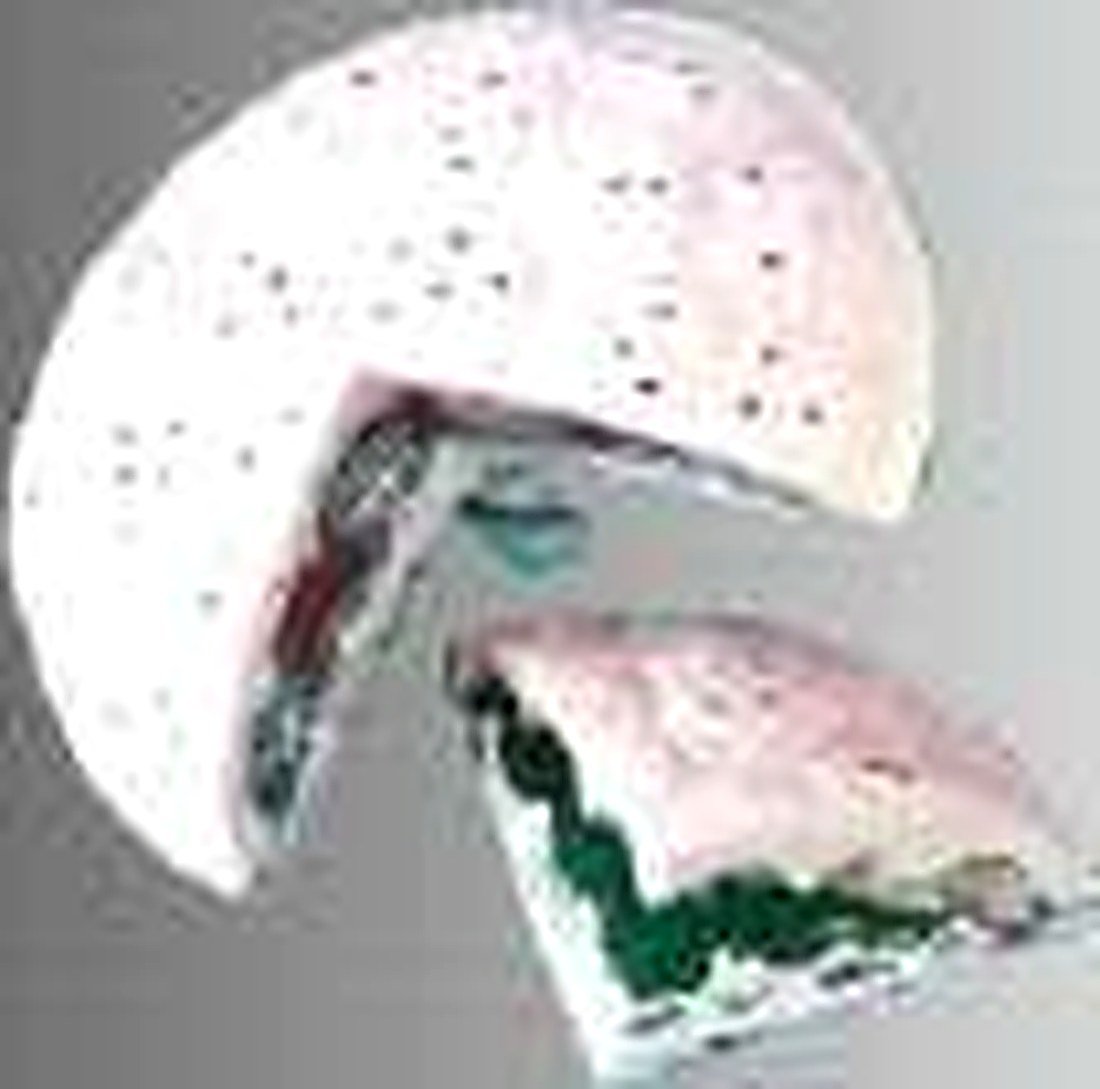 Human Placenta Anatomise Model (Imported) — detail view | VistaStay Med