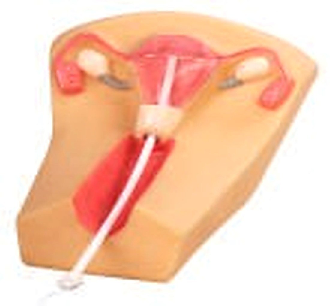 IUD TRAINING SIMULATOR (IMPORTED) - Basing — product photograph | VistaStay Med