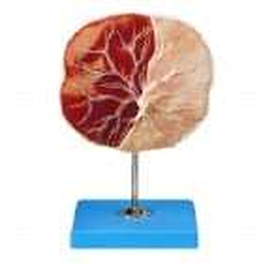 Human Placenta Model(Imported) — product photograph | VistaStay Med