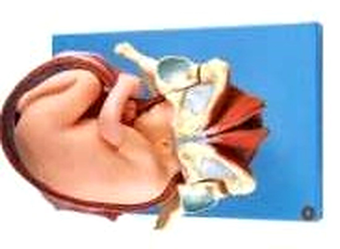Demonstration Model Of A Child Birth 3 Stages (Imported) — product photograph | VistaStay Med