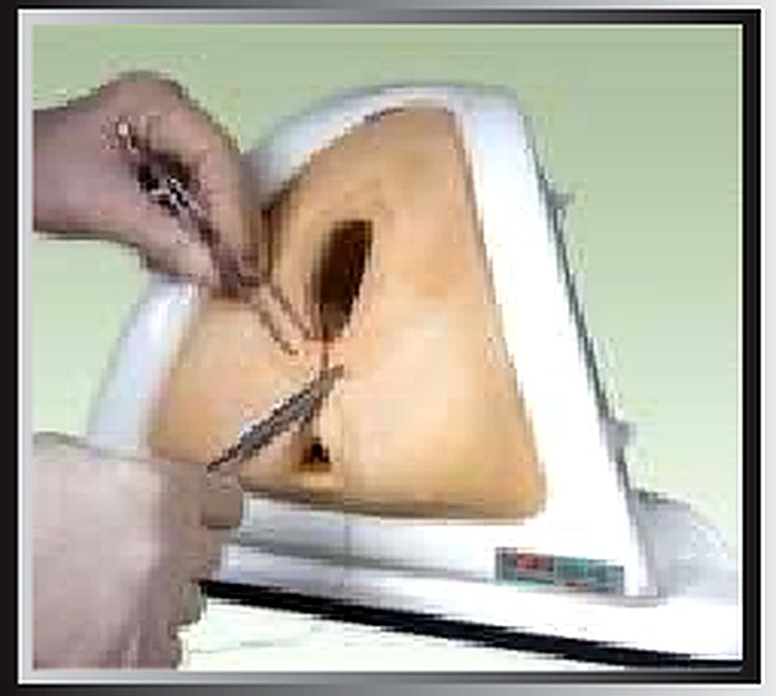 Perineum Cutting And Suturing Training — product photograph | VistaStay Med