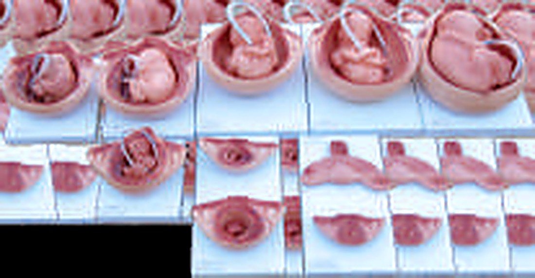 Development Process Of A Fetus — product photograph | VistaStay Med