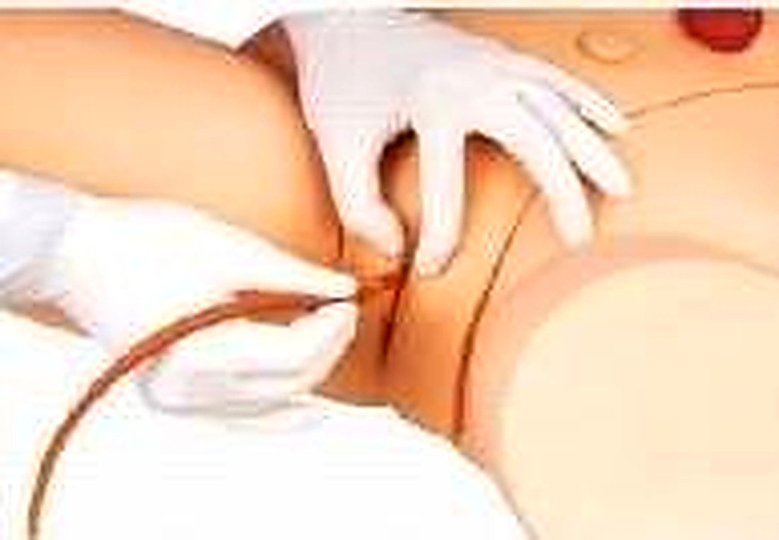 Female Catherization Training Simulator — product photograph | VistaStay Med