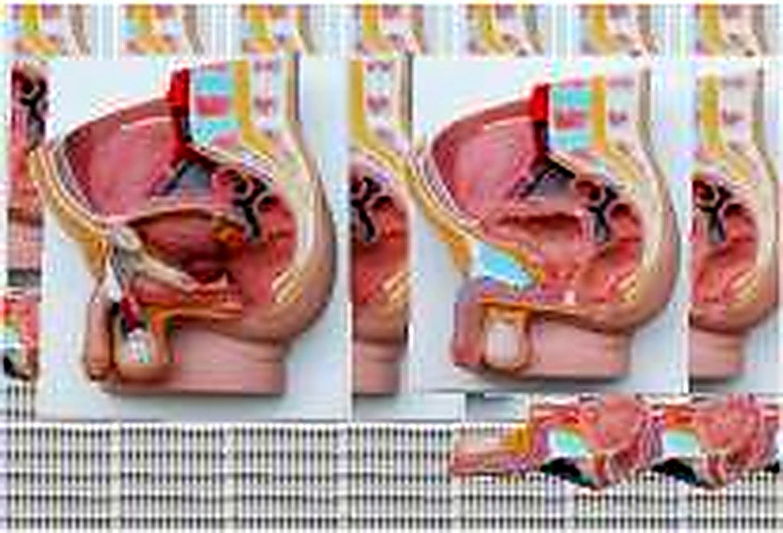 Human Male Pelvis Section (2 Part) — product photograph | VistaStay Med