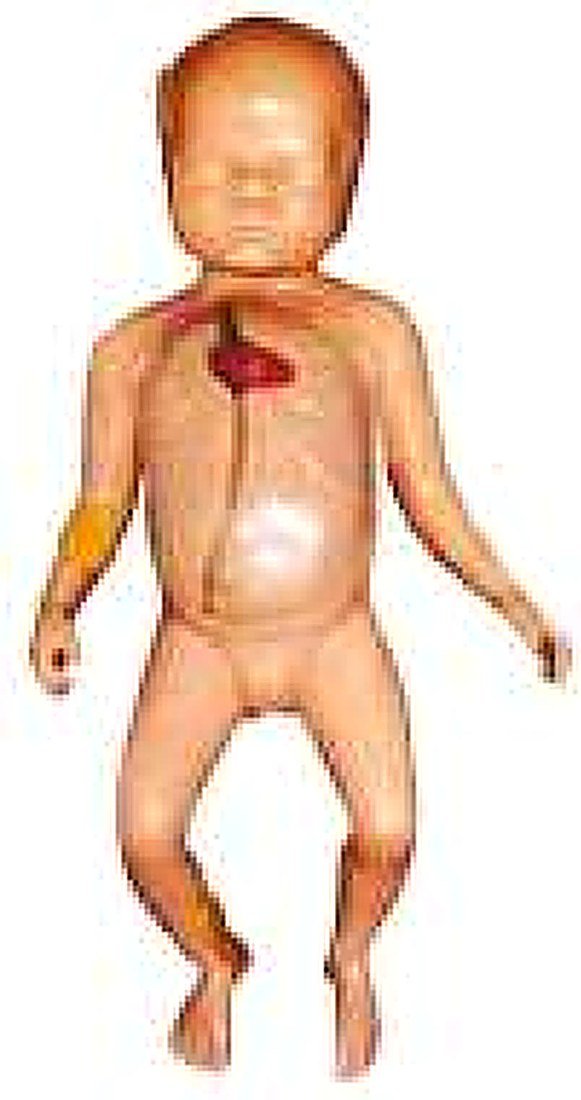 Advanced Neonatal Peripheral And Central Vein Intubation Simulator — product photograph | VistaStay Med