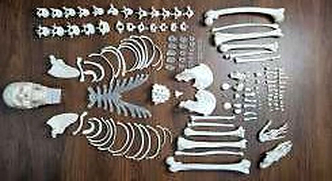 Disarticulated Skeleton (Imported) — product photograph | VistaStay Med