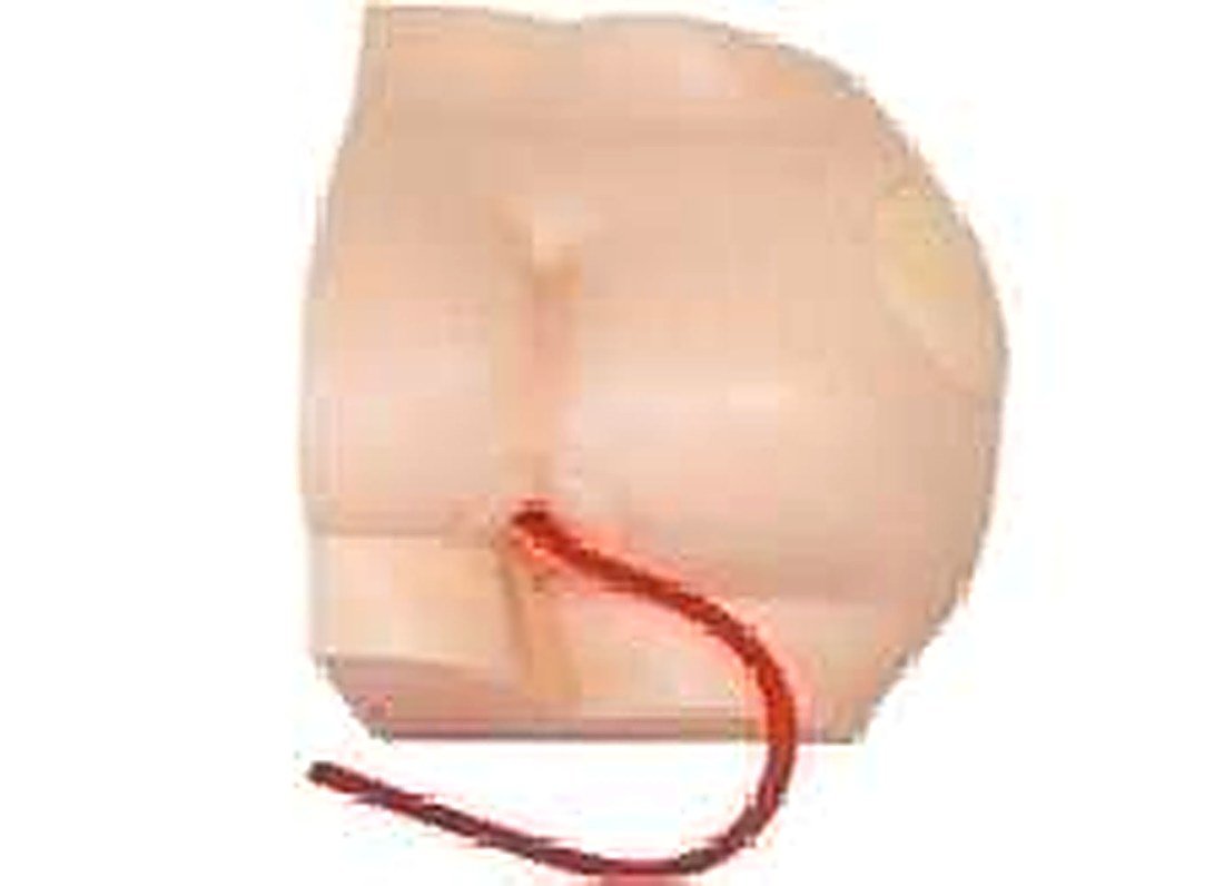 Buttock Intramuscular Injection Model — product photograph | VistaStay Med