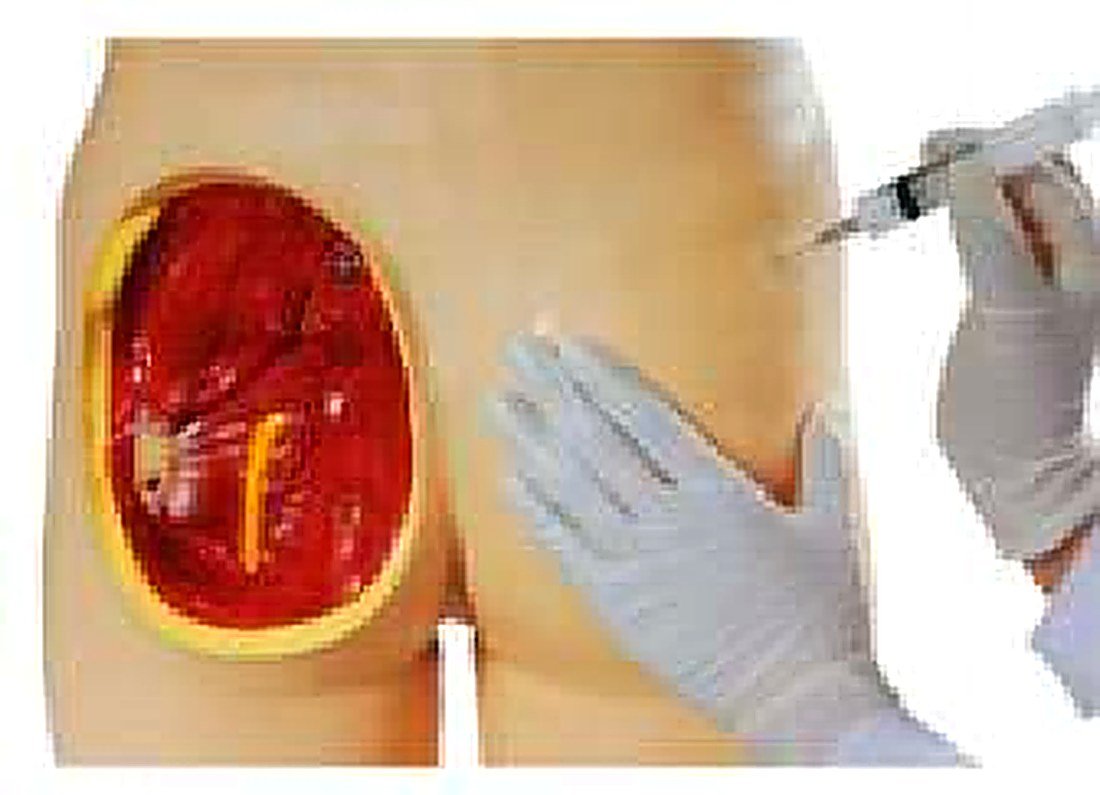 Adult Intramuscular Injection Training — product photograph | VistaStay Med