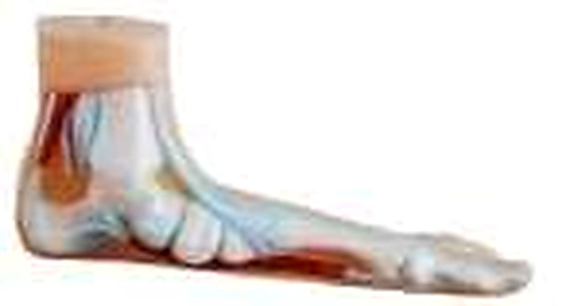 FOOT ANATOMY MODEL 3 PARTS/NORMAL, FLAT AND ARCHED FOOT (IMPORTED)- These — product photograph | VistaStay Med