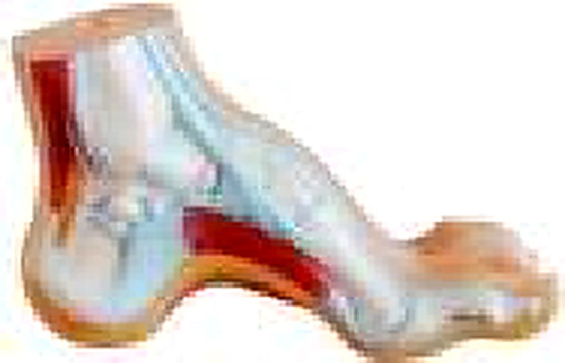 FOOT ANATOMY MODEL 3 PARTS/NORMAL, FLAT AND ARCHED FOOT (IMPORTED)- These — detail view | VistaStay Med