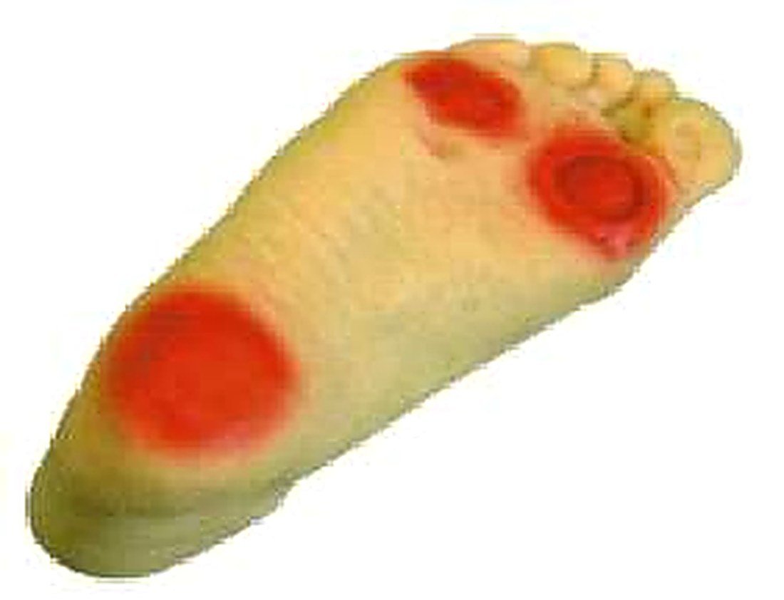 Advanced Diabetic Foot Care Model — product photograph | VistaStay Med