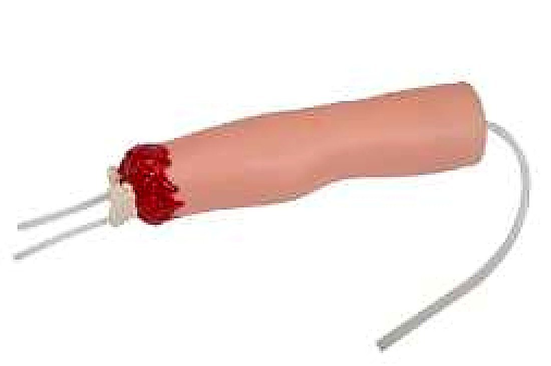 Upper Limb Trauma Amputation Nd Hemostasis Model — product photograph | VistaStay Med