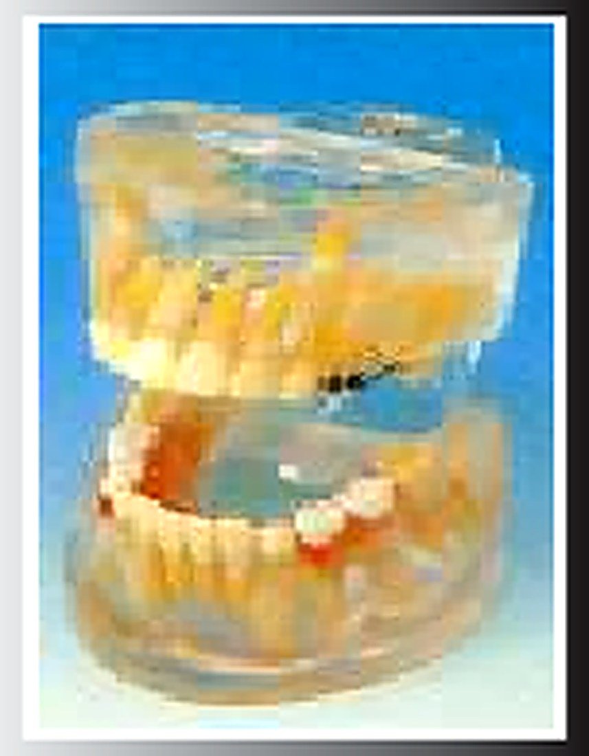 Transparent Milk Teeth Development — product photograph | VistaStay Med
