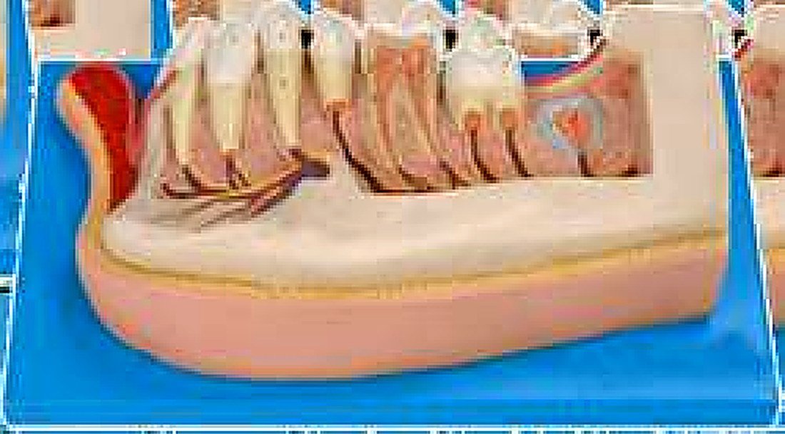 LOWER JAW OF 12-YEARS OLD - The Model — product photograph | VistaStay Med