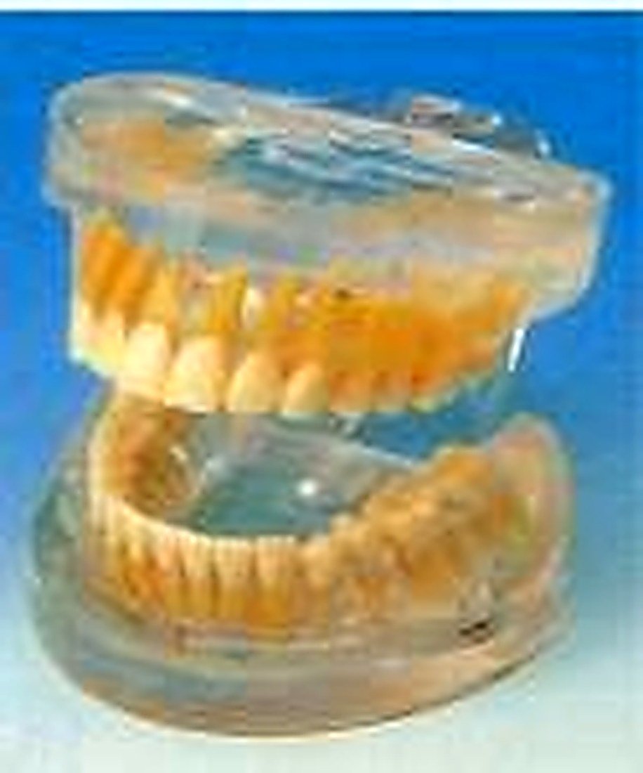 TRANSPARENT ADULT TEETH MODEL - The — product photograph | VistaStay Med