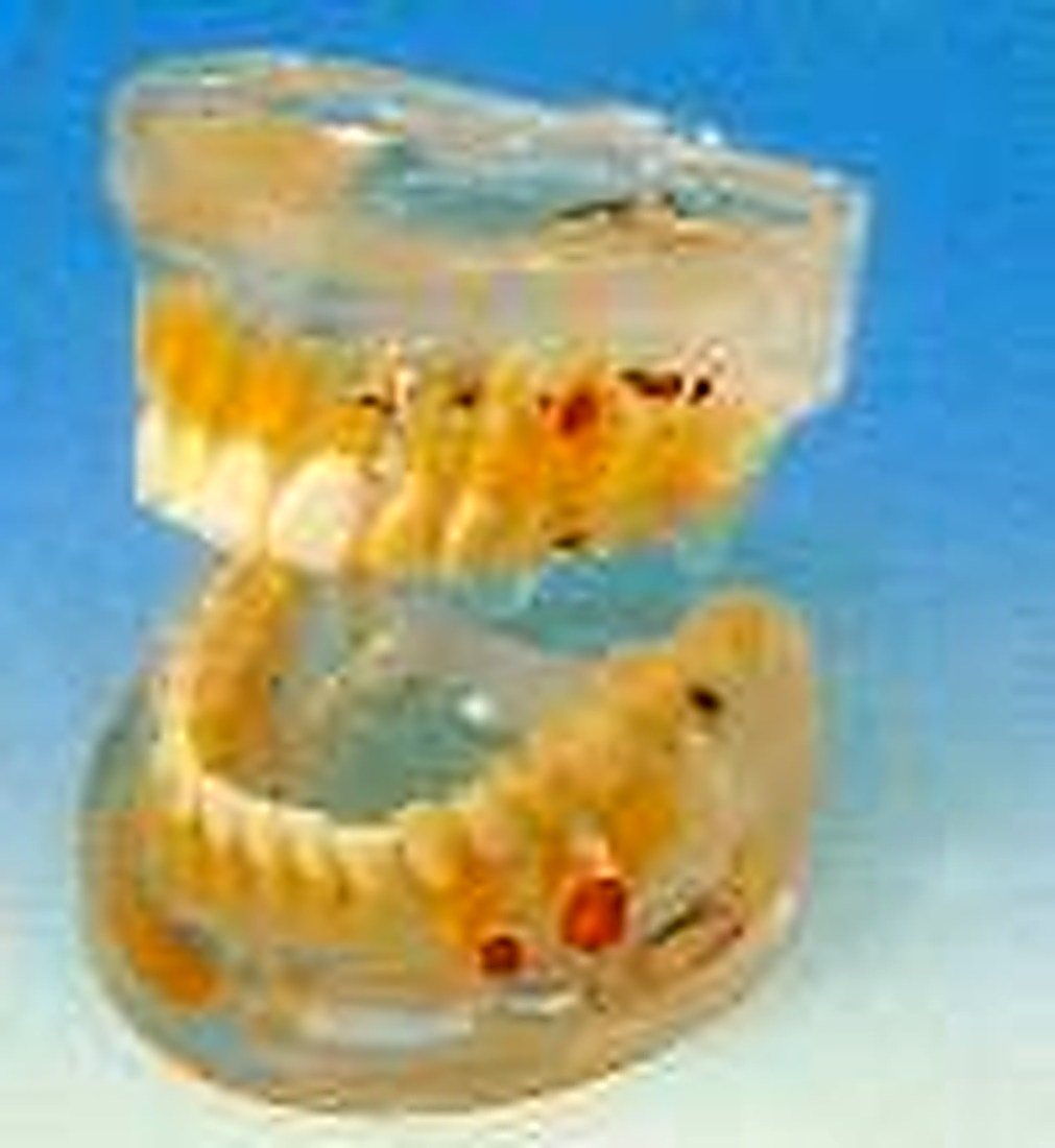 Transparent Dental Pathology Model — product photograph | VistaStay Med