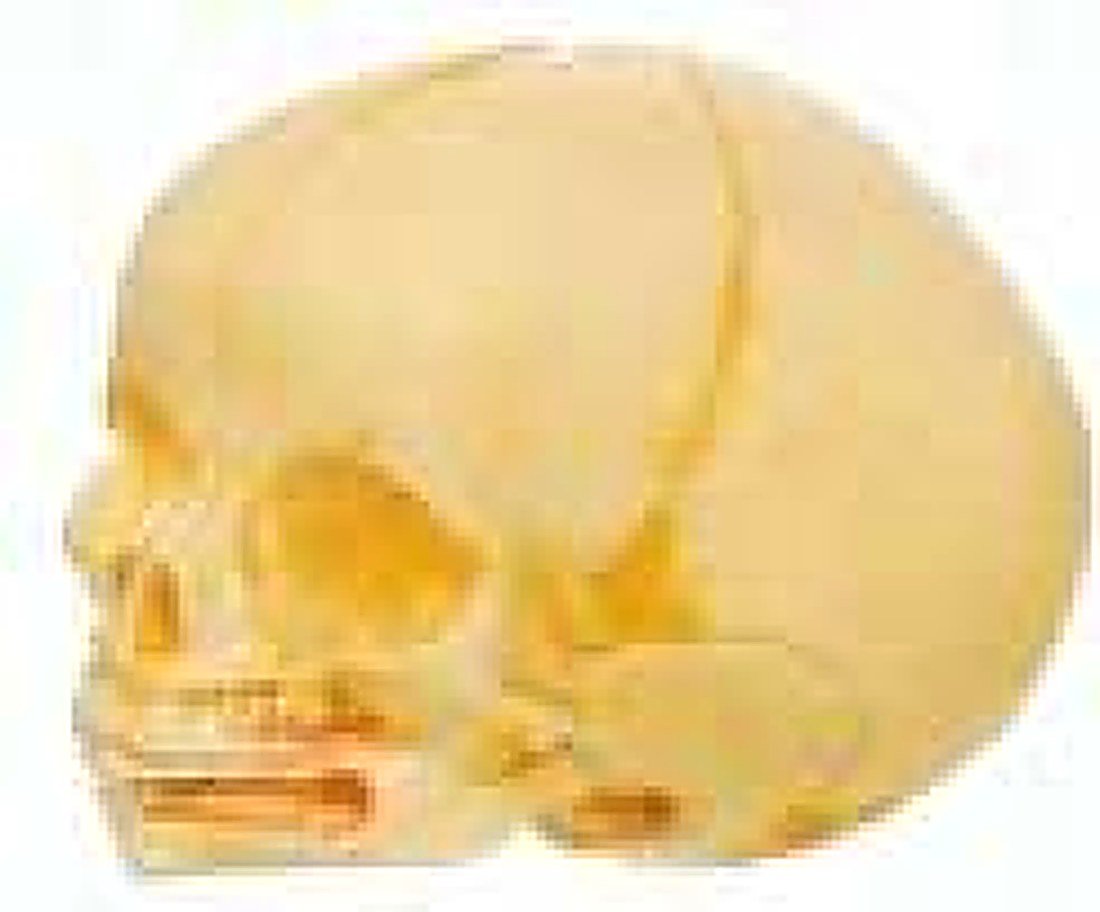 INFANT SKULL MODEL(IMPORTED)- Be separated — product photograph | VistaStay Med