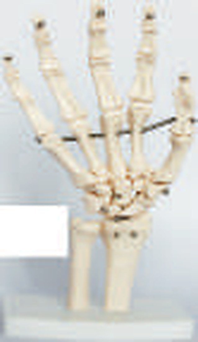 HAND JOINT (IMPORTED) - Demonstrate all the hand functionality and the external anatomical structures. Made of PVC plastic, life size, on stand. Size: 11.5x8x24.5CM. — product photograph | VistaStay Med