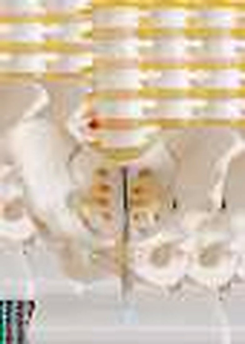 Pelvis With 5 Piece Lumbar Vertebrae — product photograph | VistaStay Med