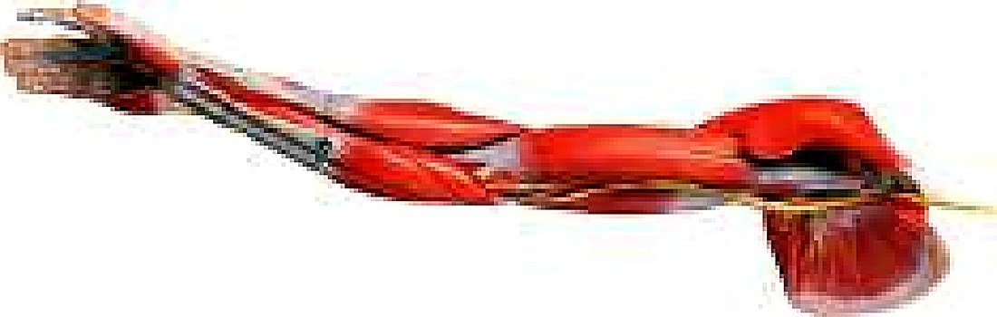 Muscles Of Arm With Main Vessels And — product photograph | VistaStay Med