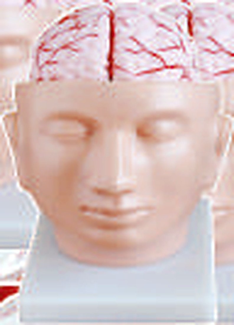 Brain With Arteris On Head (Imported) — product photograph | VistaStay Med