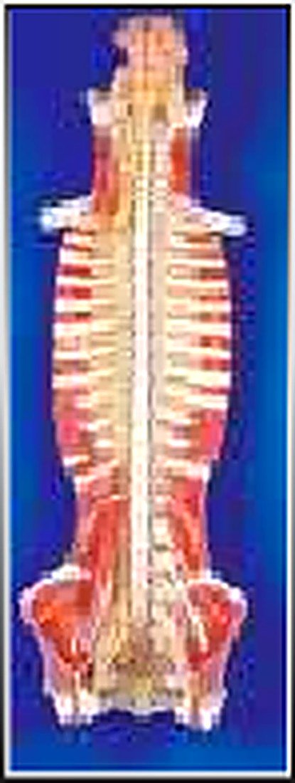 Spinal Cord In Spinal Canal(Imported) — product photograph | VistaStay Med