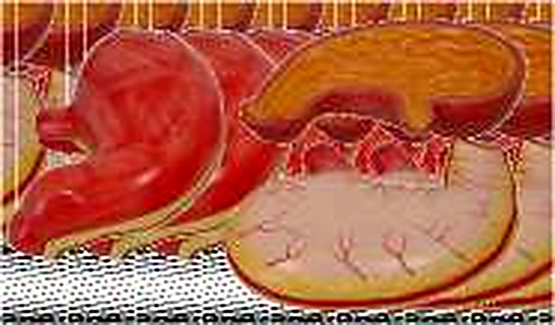STOMACH MODEL (IMPORTED) - the model shows the structures of the gastric folds, pyloric valve, pyloric sphincter muscles, gastric mucosa and the transitional mucosa of the gastric-esophagus. Made of hard plastic and magnified 2 times of the natural size. — product photograph | VistaStay Med